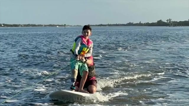  Boy who lost part of leg in Lower Keys shark attack talks recovery, treatment at Nicklaus Children’s Hospital 