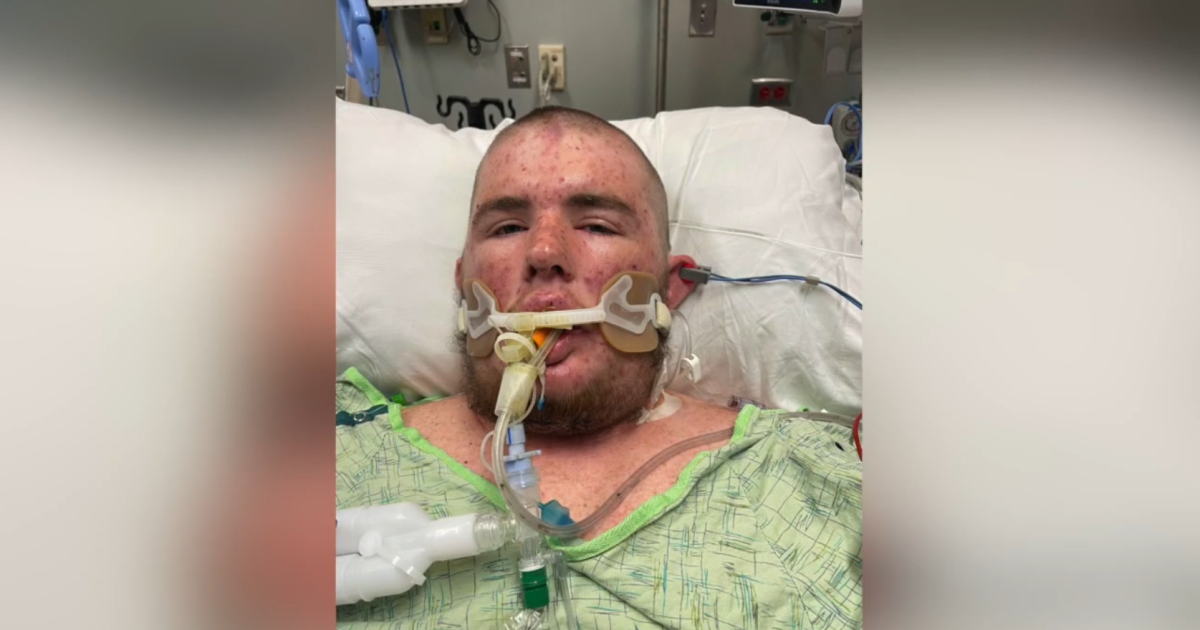  Ripley man wakes up from medically induced coma after being stung by a swarm of bees 'thousands' of times 