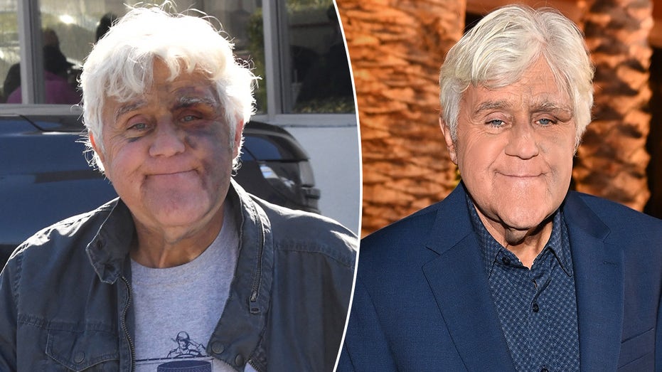  Jay Leno ‘feeling good’ despite suffering bruised face from fall 