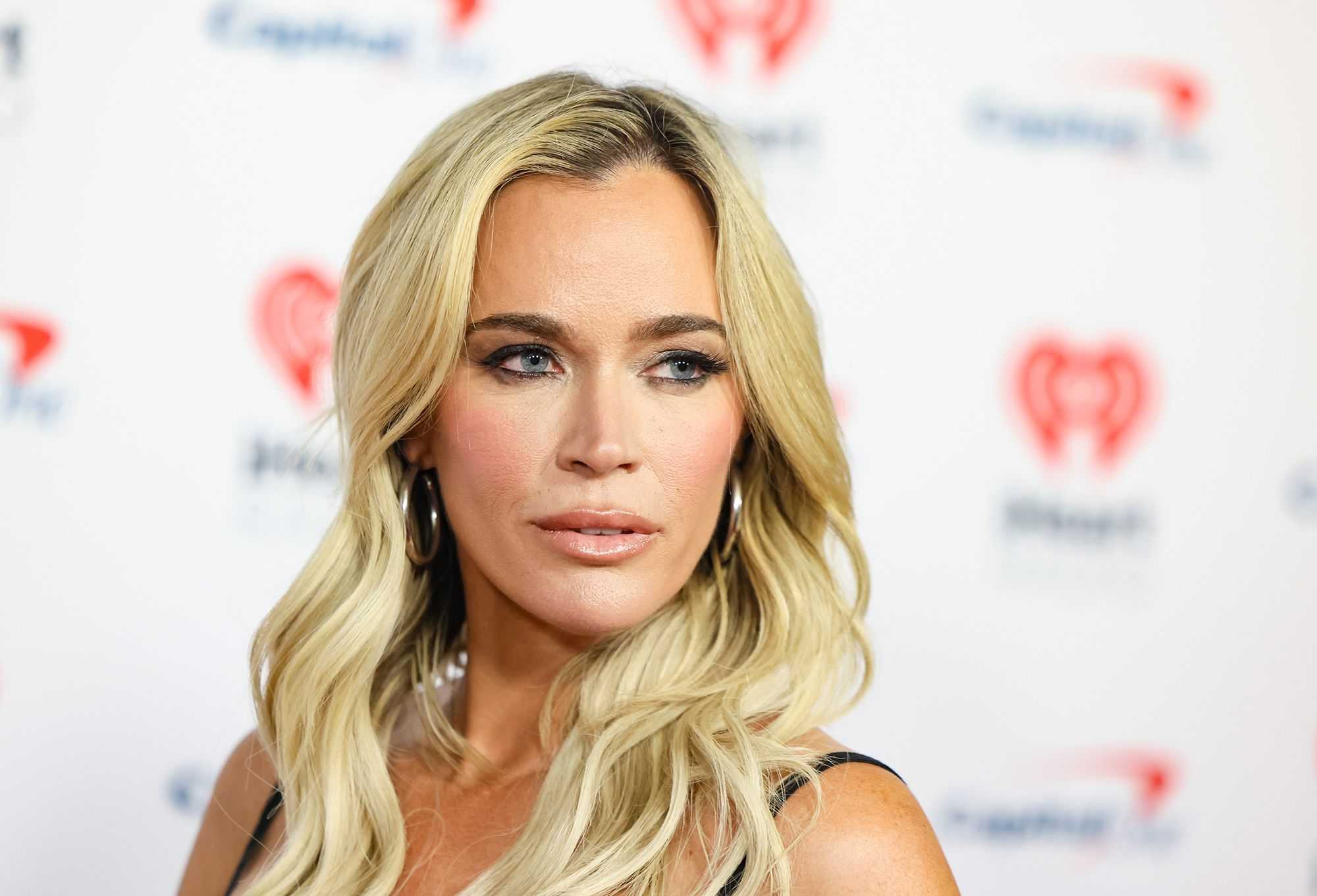  'Real Housewives of Beverly Hills' star Teddi Mellencamp reveals she has 'multiple' brain tumors 