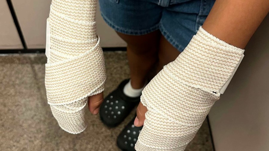  Lubbock ISD sued over cheerleaders' burn injuries from hot track punishment 