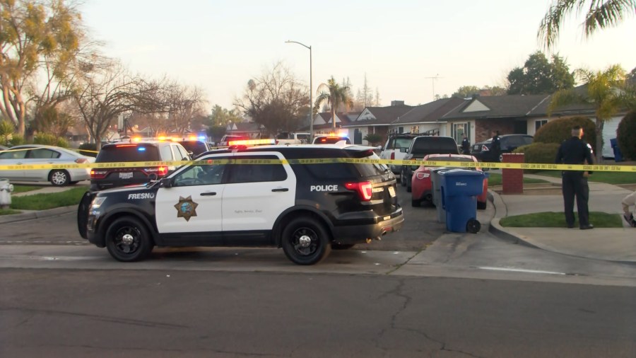  Man shot in leg in Fresno, police say 