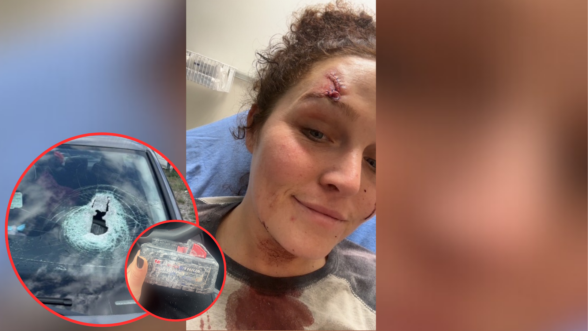  'I could've died': Woman hit in face by battery while driving to Disney World 