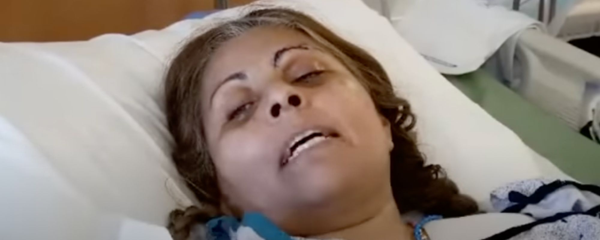  Woman Survives Deadly Factory Explosion by Falling into Liquid Chocolate 