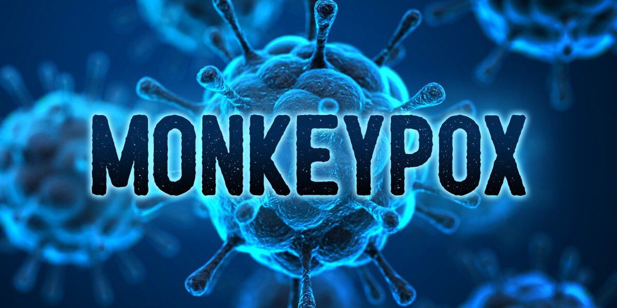  Monkeypox case confirmed at Titus Regional Medical Center 
